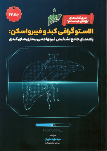 الاستوگرافی کبد و فیبرواسکن: راهنمای جامع تشخیص غیر تهاجمی بیماری‌های کبدی