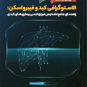 الاستوگرافی کبد و فیبرواسکن: راهنمای جامع تشخیص غیر تهاجمی بیماری‌های کبدی