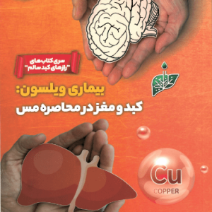 بیماری ویلسون: کبد و مغز در محاصره مس