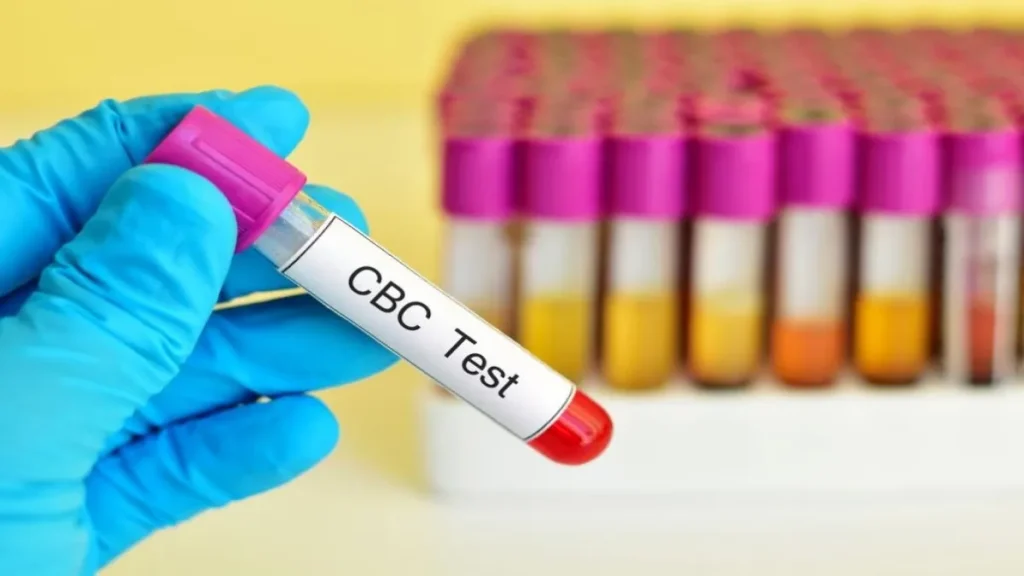 آزمایش CBC چیست؟