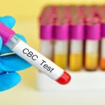 آزمایش CBC چیست؟
