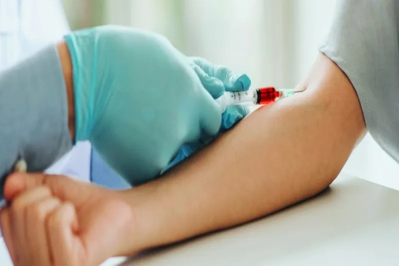 آزمایش چکاپ کامل برای بیماری های مقاربتی