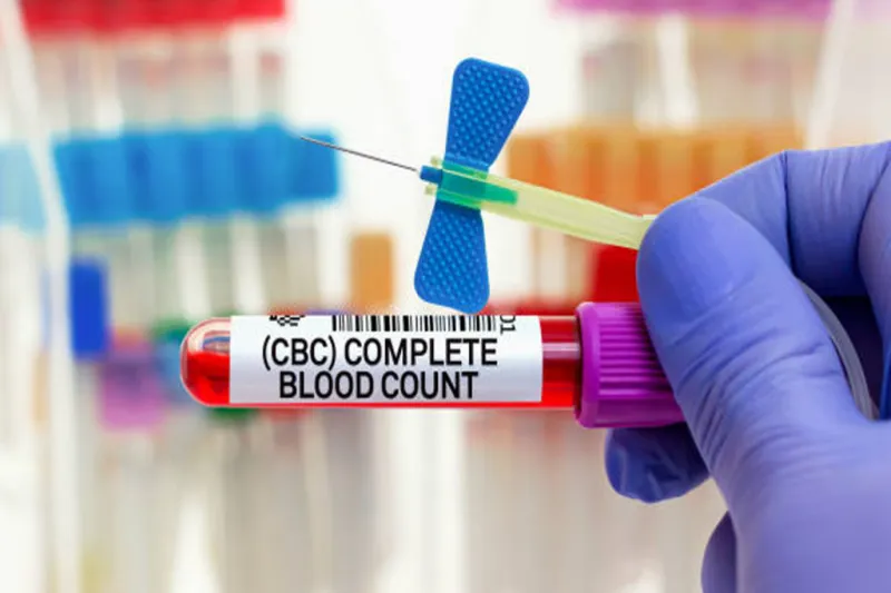 اجزای آزمایش CBC