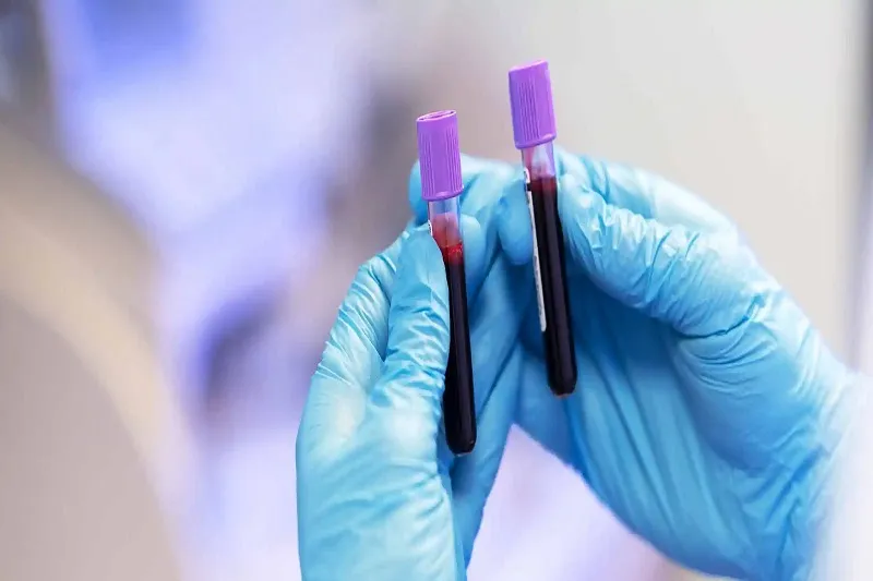 سایر پارامترهای آزمایش CBC