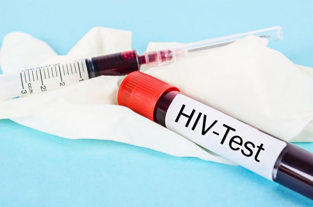 دقت آزمایش HIV چقدر است؟