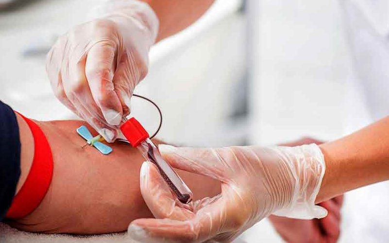 آزمایش‌های چکاپ کامل مردان 2