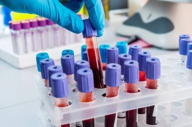 آزمایش‌های چکاپ کامل مردان 3