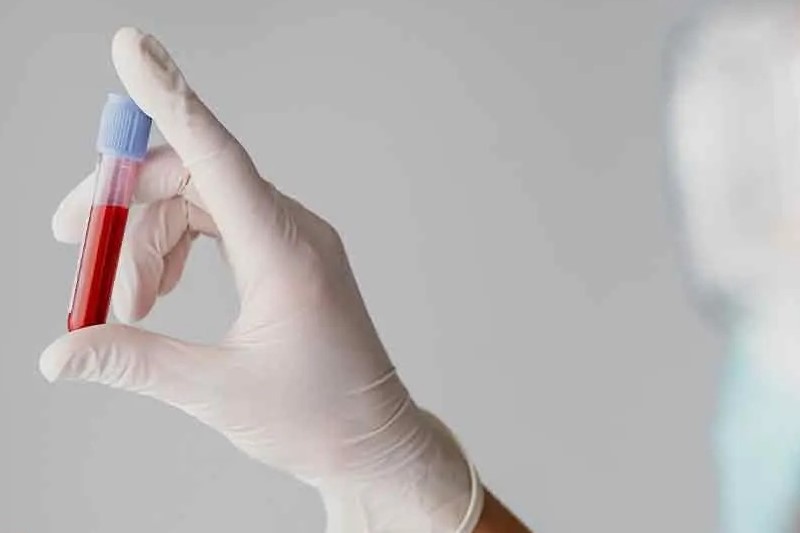 چکاپ جامع سالمندان 3