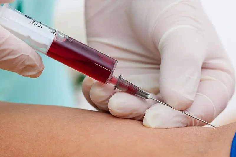 آزمایشگاه پاتوبیولوژی کیکاووس
