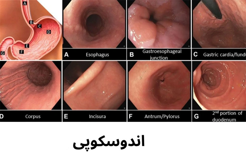 نمونه‌برداری