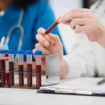 عوارض آزمایش خون و روش مدیریت آن