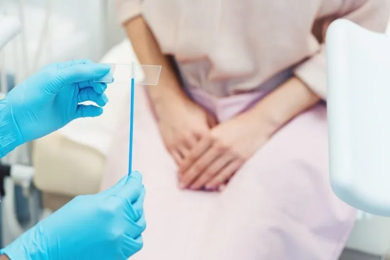آزمایش HPV در منزل 2