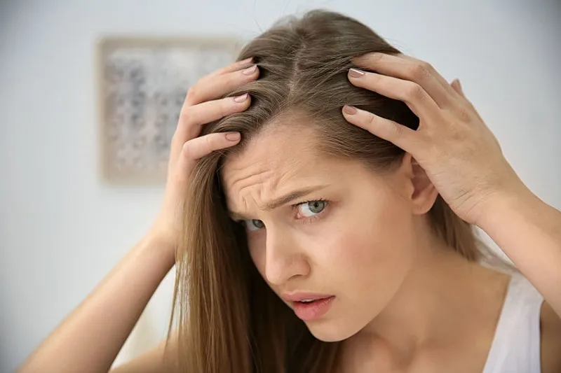 ارتباط بین کبد چرب و ریزش مو 3