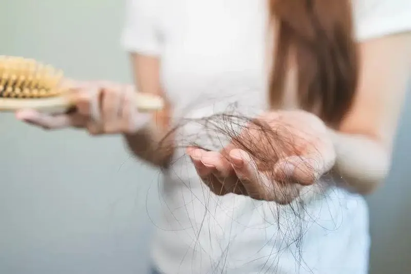چه آزمایش هایی برای ریزش مو لازم است؟ 4