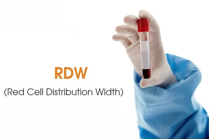 rdw در آزمایش خون 1